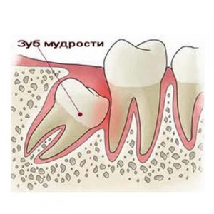 Лечение и удаление зубов