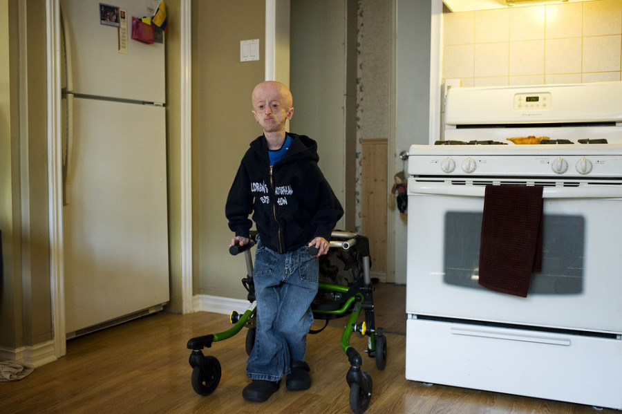У Дэвина артрит с двух лет, и в шесть лет у него было два инсульта. Для передвижения ему необходимы ходунки.