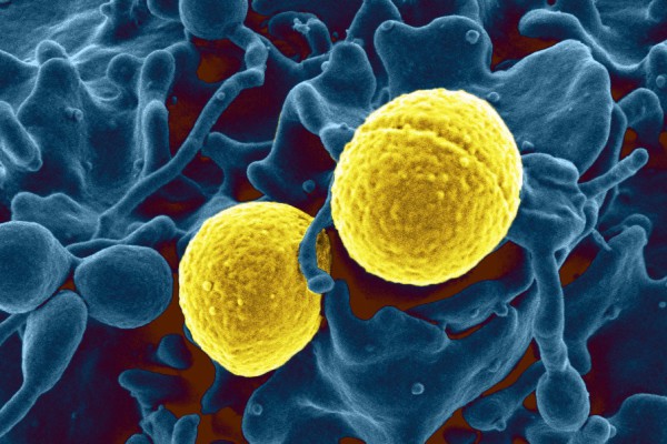 Ученые из Университета Висконсин-Мэдисон отыскали в человеческом организме белок, который способен отличать здоровые клетки организма от атакующих их микробов.